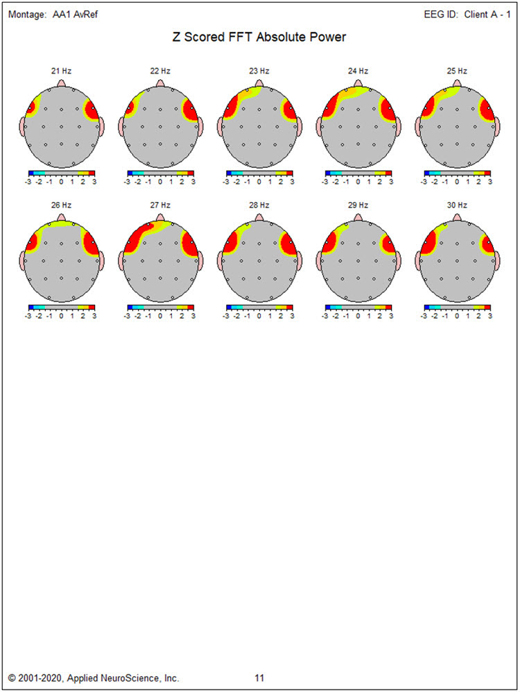 Z-scored FFT absolute power topographic maps continued
